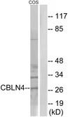 Anti-CBLN4 antibody used in Western Blot (WB). GTX87225