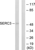 Anti-TDE1 antibody used in Western Blot (WB). GTX87321