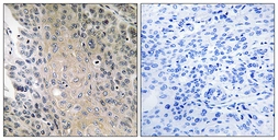 Anti-RAB41 antibody used in IHC (Paraffin sections) (IHC-P). GTX87334