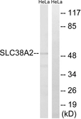 Anti-SLC38A2 antibody used in Western Blot (WB). GTX87368