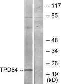 Anti-TPD52L2 antibody used in Western Blot (WB). GTX87379
