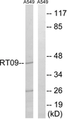 Anti-MRPS9 antibody used in Western Blot (WB). GTX87450