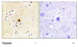 Anti-RyR2 antibody used in IHC (Paraffin sections) (IHC-P). GTX87462