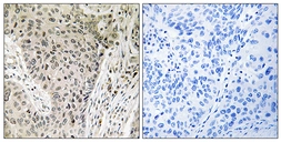 Anti-ARHGEF19 antibody used in IHC (Paraffin sections) (IHC-P). GTX87469