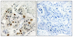 Anti-AF4 antibody used in IHC (Paraffin sections) (IHC-P). GTX87470