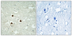 Anti-RAB3IP antibody used in IHC (Paraffin sections) (IHC-P). GTX87492
