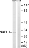 Anti-NXPH1 antibody used in Western Blot (WB). GTX87524