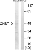Anti-CHST10 antibody used in Western Blot (WB). GTX87551