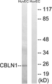 Anti-CBLN1 antibody used in Western Blot (WB). GTX87593