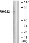 Anti-ARHGAP22 antibody used in Western Blot (WB). GTX87597