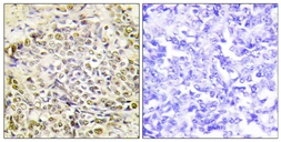 Anti-IRX2 antibody used in IHC (Paraffin sections) (IHC-P). GTX87634