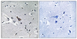 Anti-SLC6A16 antibody used in IHC (Paraffin sections) (IHC-P). GTX87647
