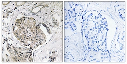 Anti-USP40 antibody used in IHC (Paraffin sections) (IHC-P). GTX87648