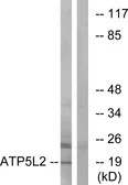 Anti-ATP5L2 antibody used in Western Blot (WB). GTX87665