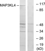 Anti-MLK4 antibody used in Western Blot (WB). GTX87671