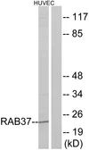 Anti-RAB37 antibody used in Western Blot (WB). GTX87674