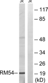 Anti-MRPL54 antibody used in Western Blot (WB). GTX87675