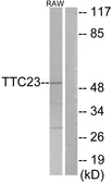 Anti-TTC23 antibody used in Western Blot (WB). GTX87729