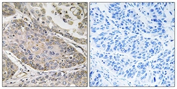 Anti-PLA2G4E antibody used in IHC (Paraffin sections) (IHC-P). GTX87732