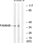 Anti-FAM84B antibody used in Western Blot (WB). GTX87774