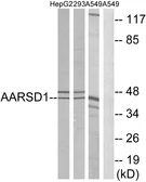 Anti-AARSD1 antibody used in Western Blot (WB). GTX87780