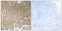 Anti-RAB34 antibody used in IHC (Paraffin sections) (IHC-P). GTX87791
