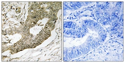 Anti-NUCKS1 antibody used in IHC (Paraffin sections) (IHC-P). GTX87841