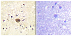 Anti-RASGRF1 antibody used in IHC (Paraffin sections) (IHC-P). GTX87849