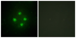 Anti-MED24 antibody used in Immunocytochemistry/ Immunofluorescence (ICC/IF). GTX87850
