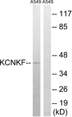 Anti-KCNK15 antibody used in Western Blot (WB). GTX87879