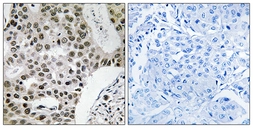 Anti-ZMYM4 antibody used in IHC (Paraffin sections) (IHC-P). GTX87903