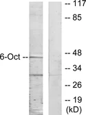Anti-OCT6 antibody used in Western Blot (WB). GTX87936