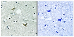 Anti-Girdin antibody used in IHC (Paraffin sections) (IHC-P). GTX87941