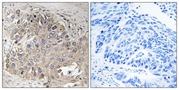 Anti-SPTBN5 antibody used in IHC (Paraffin sections) (IHC-P). GTX87945