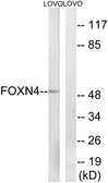 Anti-FOXN4 antibody used in Western Blot (WB). GTX87947