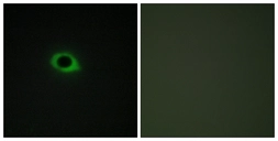 Anti-TENS3 antibody used in Immunocytochemistry/ Immunofluorescence (ICC/IF). GTX87949