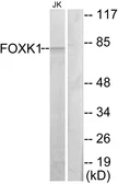 Anti-FOXK1 antibody used in Western Blot (WB). GTX87950