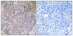 Anti-NDUFS7 antibody used in IHC (Paraffin sections) (IHC-P). GTX87977