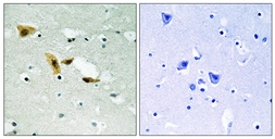 Anti-APLF antibody used in IHC (Paraffin sections) (IHC-P). GTX87979