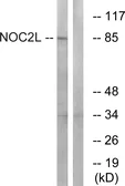 Anti-NOC2L antibody used in Western Blot (WB). GTX87980