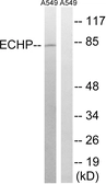 Anti-EHHADH antibody used in Western Blot (WB). GTX87989