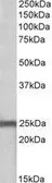 Anti-NDUFS8 antibody, Internal used in Western Blot (WB). GTX88022