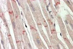 Anti-Desmoplakin (aa 1672 -1684) antibody, Internal used in IHC (Paraffin sections) (IHC-P). GTX88029