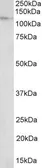 Anti-NUP107 antibody, Internal used in Western Blot (WB). GTX88032