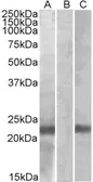 Anti-Cystatin 8 (aa 100-112) antibody, Internal used in Western Blot (WB). GTX88034