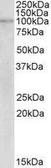 Anti-NLRX1 antibody, Internal used in Western Blot (WB). GTX88038