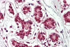 Anti-Cullin 2 antibody, C-term used in IHC (Paraffin sections) (IHC-P). GTX88108