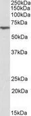 Anti-ANTXR2 antibody, Internal used in Western Blot (WB). GTX88121