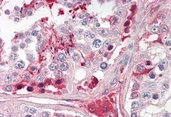Anti-CRISP2 antibody, Internal used in IHC (Paraffin sections) (IHC-P). GTX88148