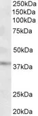 Anti-GHITM (aa117-127) antibody, Internal used in Western Blot (WB). GTX88163